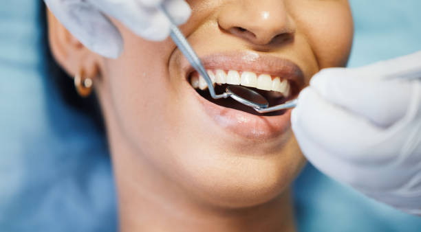 Best Emergency Tooth Extraction in Coolidge, AZ